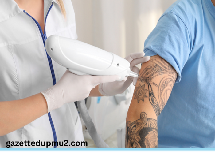 Why Medical Village is the Best Laser Tattoo Removal treatment in Dubai