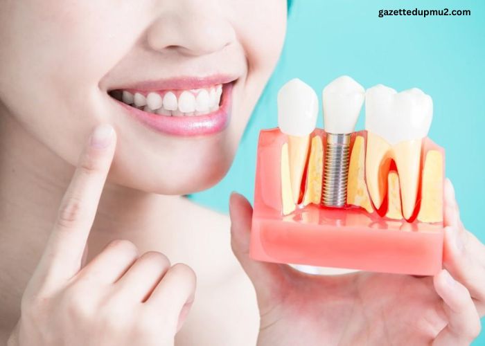 Implants That Last: Why Dental Implants Are the Gold Standard in Tooth Replacement